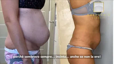 Вмешательства до и после | Darecchio Surgery