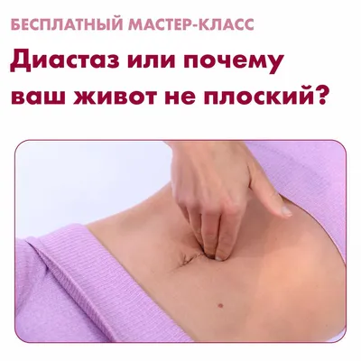 Диастаз мышц живота | Frau Klinik - rлиника пластической хирургии и  косметологии