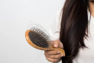 Tryfonova M.D. - На фото результат лечения выпадения волос . У данной  пациентки - диффузное выпадение волос . Причиной выпадения стала операция,  точнее наркоз . После наркоза, более 50% пациентов жалуются на