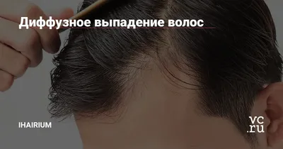 Мощное средство для роста волос против выпадения волос против облысения  быстрое восстановление волос | AliExpress