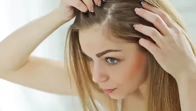 Лечение выпадения волос у женщин, облысение на висках