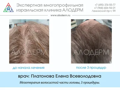 Быстрое восстановление волос | AliExpress