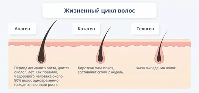 Лечение алопеции в Москве в отделении дерматовенерологии клиники ИАКИ