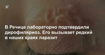 В Новороссийске длинного-длинного «червяка» вытащили из-под кожи пациента –  Новости Новороссийска