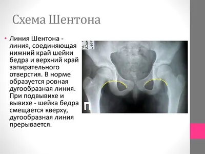 Рентген тазобедренного сустава - 6 адресов | Цены от 322 рублей в  Краснодаре на LocalLab.ru