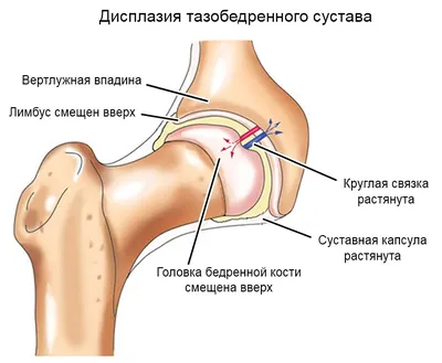 Дисплазия тазобедренных суставов у собак - Ветеринарный Центр «Прайд»