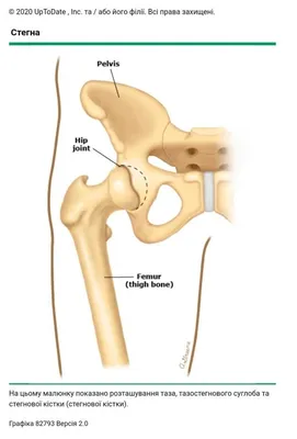 Дисплазия/вывих тазобедренного сустава - стр. 102 - Консультации ортопеда -  Форум сообщества \"Дети-ангелы\"