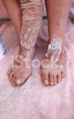 Зрелая Женщина, Применяя Крем Экзема На Ногах Стоковые Фотографии |  FreeImages