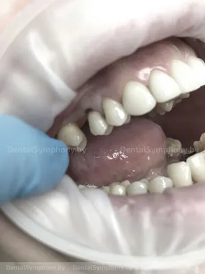 STOMWEB — Строение дна полости рта