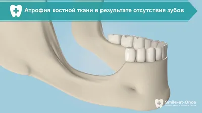 Долго болит десна после удаления зуба (Москва) - Профессиональный  стоматологический портал (сайт) «Клуб стоматологов»