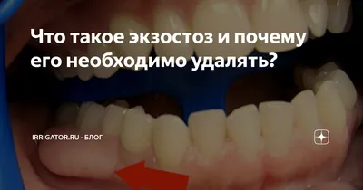 Долго болит после удаления зуба - Хирургическая стоматология - Стоматология  для всех
