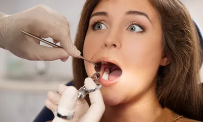Что такое экзостоз челюсти? Опасен ли он?