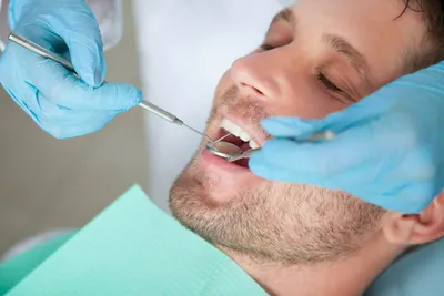 Съёмное протезирование зубов в Краснодаре