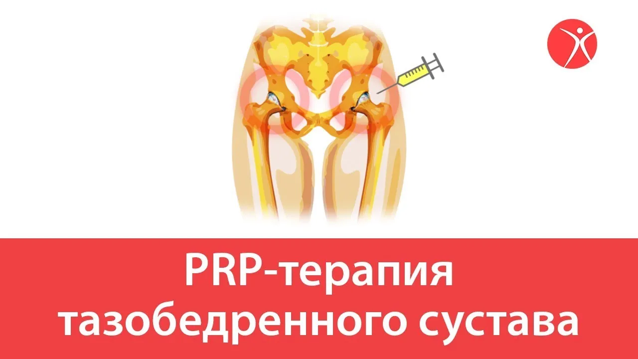 Плазмолифтинг Для Тазобедренных Суставов Отзывы Цена