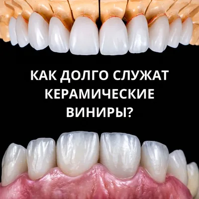 Фарфоровые виниры в Москве: цены, фото, отзывы, стоимость фарфоровых  виниров на зубы