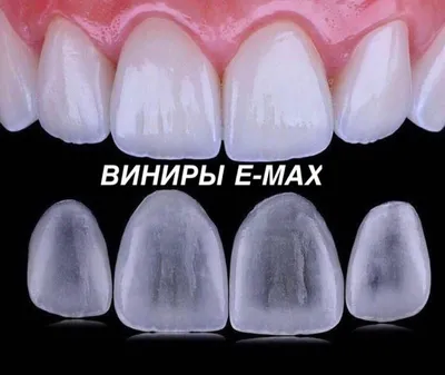 70 шт./пакет бежевые ультратонкие Стоматологические Пленки, фарфоровые  виниры для зубов из смолы, верхние передние зубные отбеливающие медицинские  инструменты для здоровья | AliExpress