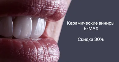 Керамические виниры (фарфоровые) - стоимость услуги Виниры в Киеве,  Керамические виниры (фарфоровые) - цена в стоматологии lipinskii.com.ua