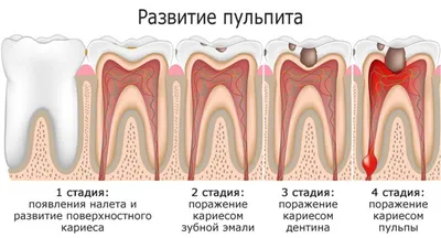 Гингивит — признаки и симптомы, формы, диагностика и лечение, медицинские  препараты