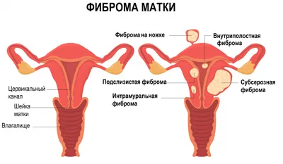 Гингивит — признаки и симптомы, формы, диагностика и лечение, медицинские  препараты