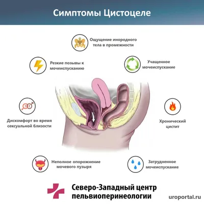 Лечение фимоза без операции у взрослых и детей в Москве - цены в клинике  АльтраВита