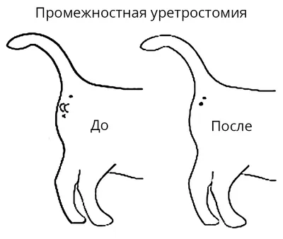 Интимная пластика у мужчин