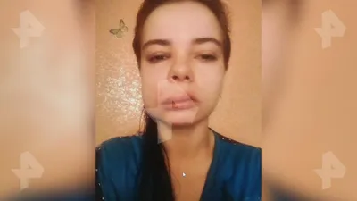 Лечение флюса в клинике ROOTT в Москве - стоимость лечения