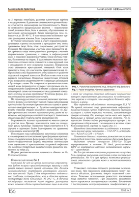 DERMAQUEST » Пятна на лице после лазера: как избежать| Статьи | Отзывы |  Купить