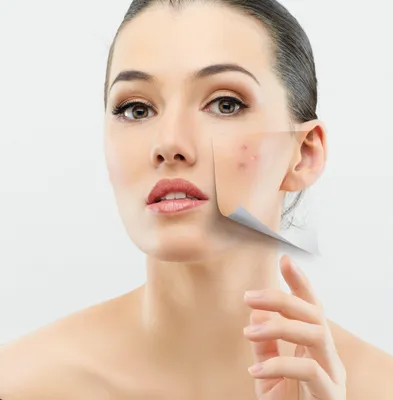 Салон краси InesBeauty - Попробуйте и вы: тейпирование лица и шеи! Длинная  шея и подтянутая кожа лица после первого раза. Какой эффект вы получаете? -  уменьшение морщин на шее - улучшение овала