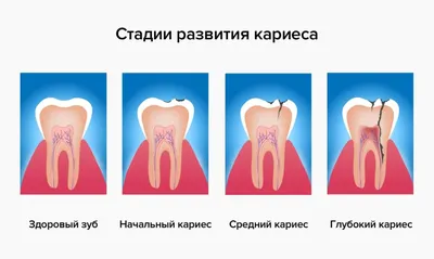 Флюс зуба — чем опасен? | Статьи стоматологии в Николаеве