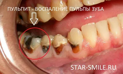 Флюс | Юлия Селютина | Дзен