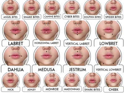 Техники увеличения губ. Что можно сделать с губами в кабинете косметолога?