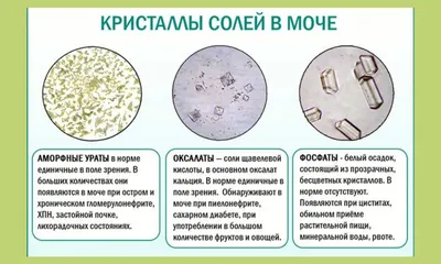 Сдать анализ Фосфор неорганический мочи на дому в Москве. Цена 390 рублей.