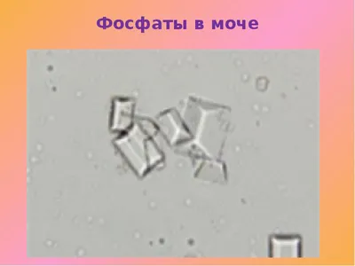 Определение неорганического фосфора в моче - сдать анализ в  Санкт-Петербурге в ЛабСтори