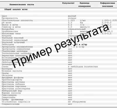 Общий анализ мочи часть 5. Расшифровка результатов. - Многопрофильный  медицинский центр \"КЛЕВЕР\"