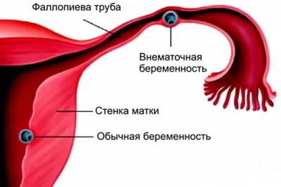 ПРОБЛЕМА ОПРЕДЕЛЕНИЯ НАЧАЛА ЖИЗНИ. ПРАВОВОЙ СТАТУС ЭМБРИОНА: НЕОБХОДИМОСТЬ  ЕГО УГОЛОВНО-ПРАВОВОЙ ОХРАНЫ – тема научной статьи по праву читайте  бесплатно текст научно-исследовательской работы в электронной библиотеке  КиберЛенинка