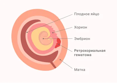 6 неделя беременности от зачатия: УЗИ плода, фото живота, что происходит с  мамой и малышом