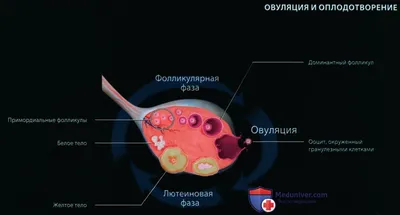 Внематочная беременность - причины и лечение | Центр медицины плода
