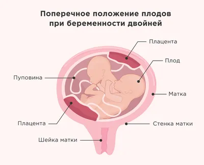 Фото 6 недельного эмбриона фотографии