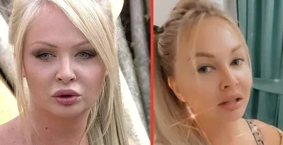 Дарья Пынзарь до и после пластики: губы, лицо, груди (фото) - 300  экспертов.РУ