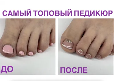 Накладные ногти для ног Kitty Nail, френч с розой, форма мягкий квадрат, 24  шт - купити за найкращою ціною в Україні ➤ KittyShop.com.ua