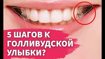 5 секретов голливудской улыбки - YouTube
