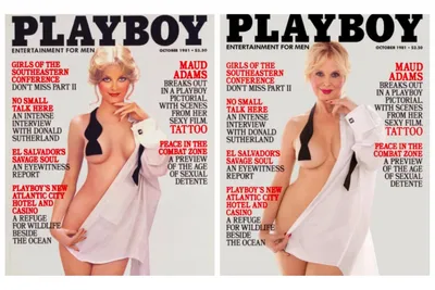 Photo: Ukraine TV Star Makes Playboy Cover After Losing Eye in Attack