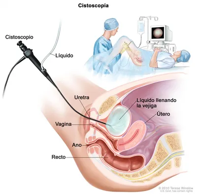 Фотодинамическая терапия лейкоплакии головки полового члена (клиническое  наблюдение) | Шаназаров | Лазерная медицина