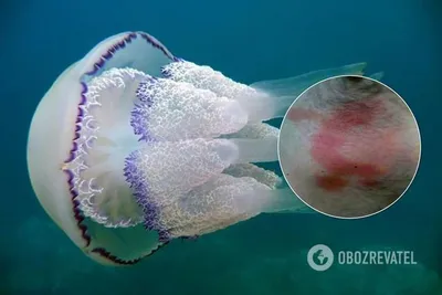 Нашествие медуз и хищных моллюсков в Азовском море: откуда взялись и как с  ними жить – Рубрика