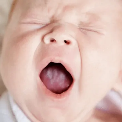 Молочница полости рта у детей – гель Холисал® от молочницы во рту у  грудничков