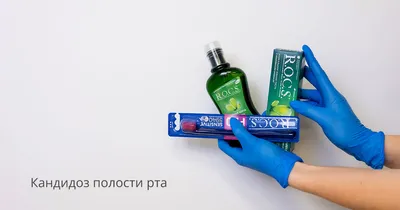 Молочница Во Рту На Языке 9 Фото Лечение Киев ЛюмиДент