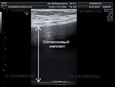 Обследование молочной железы: какой метод лучше?