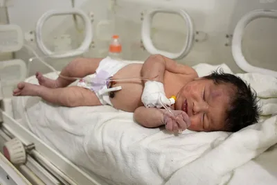 Newborn with umbilical cord intact is rescued from Syria rubble, but her  mother dies, a relative says