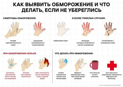 Обморожение: степени, первая помощь, профилактика - ККБ2