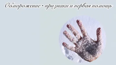 Первая помощь при обморожении » МБУ \"Защита населения и территории\" г.  Новокузнецка